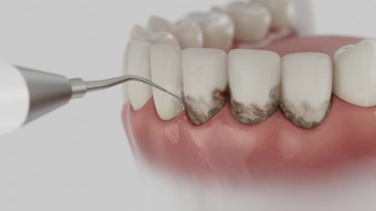 Trusted Root Canal Treatment service in Salem, VA - Dentist Open Now